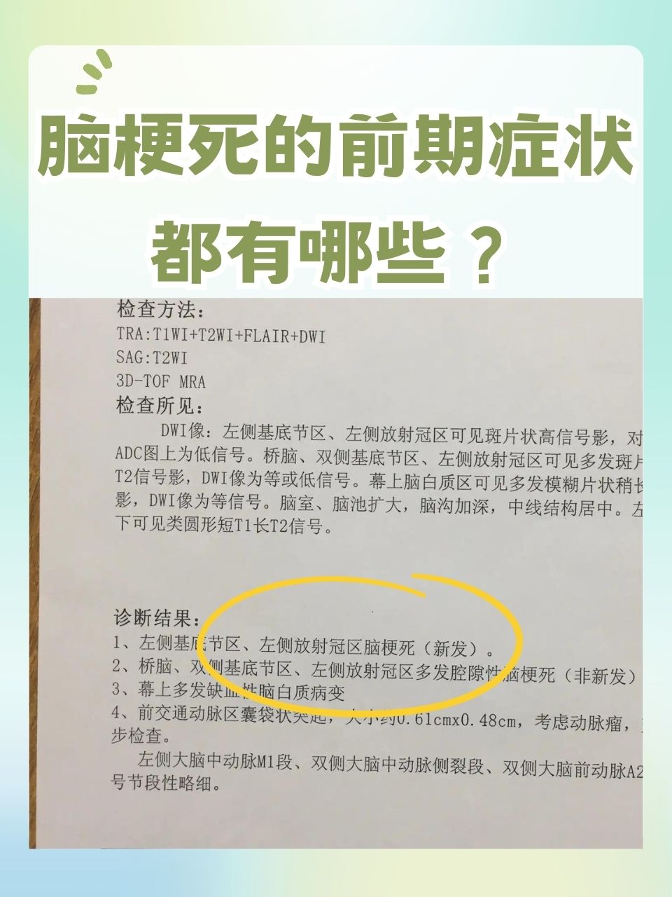 轻微脑梗塞能根治吗