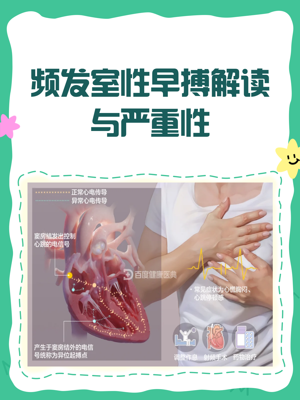 心脏早搏的症状表现