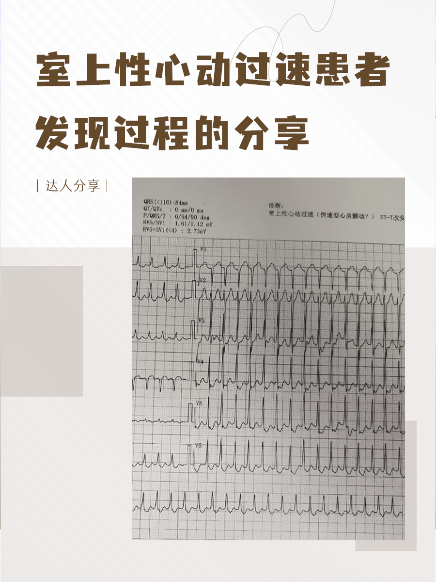 心跳慢是什么病?