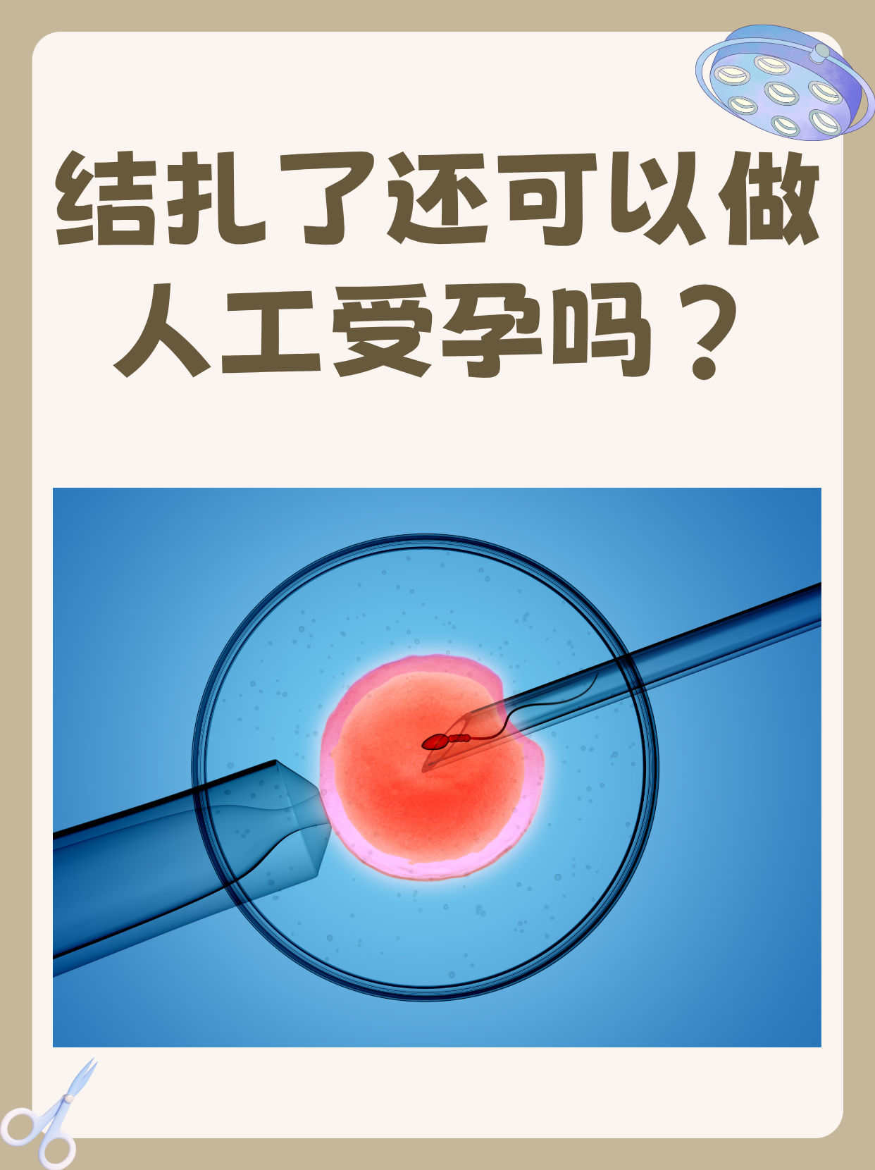 女人结扎还能生吗