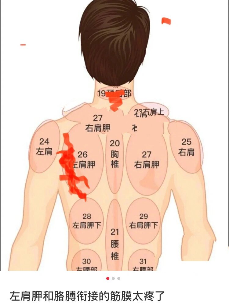 左肩膀疼是怎么回事