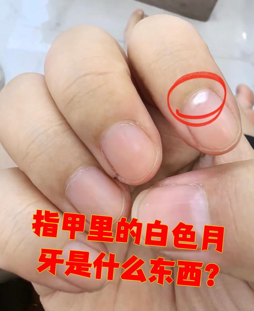 手指甲上的月牙代表什么?