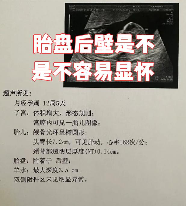 胎盘位于子宫后壁是什么意思