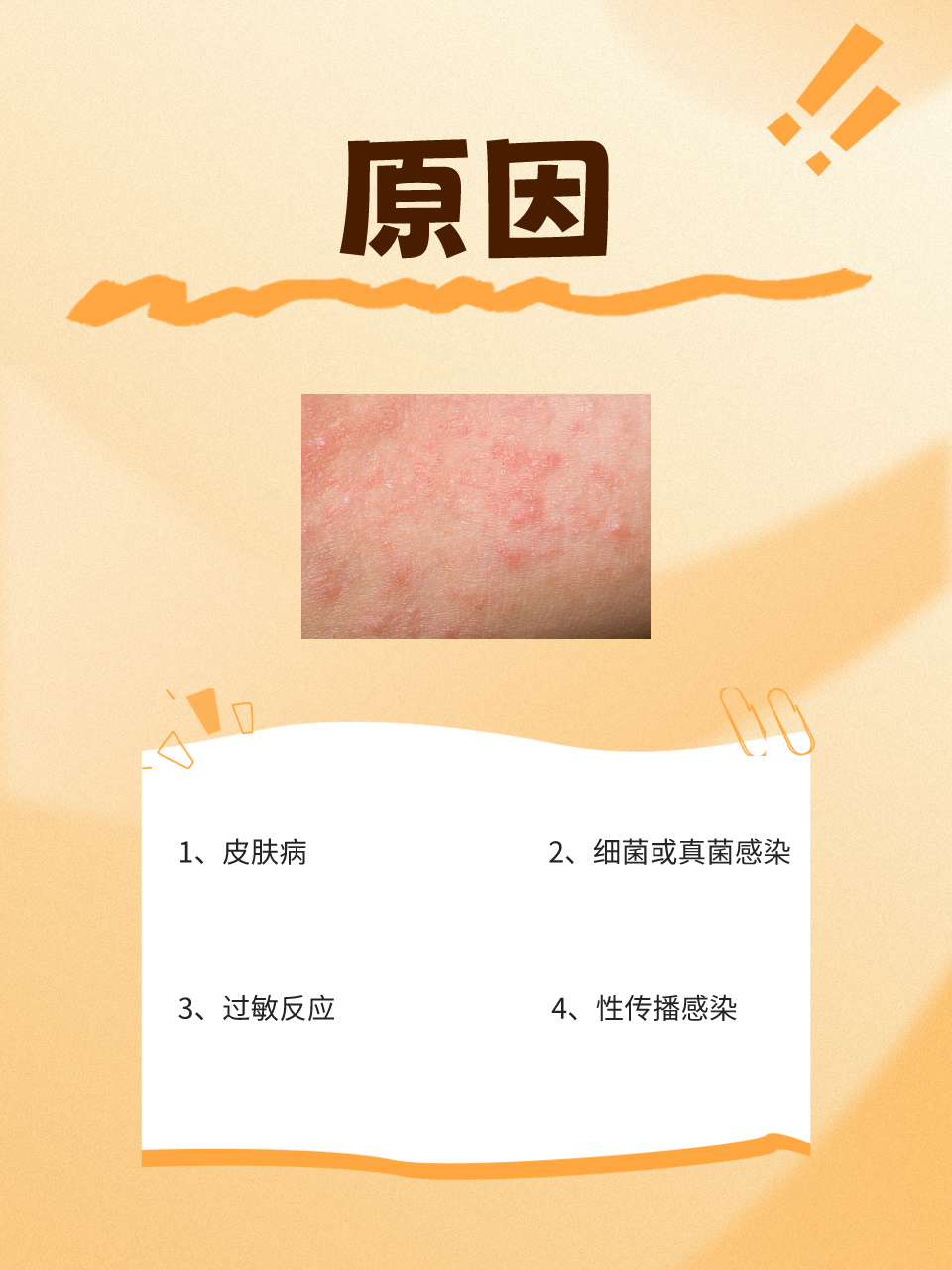 阴囊瘙痒脱皮怎么回事