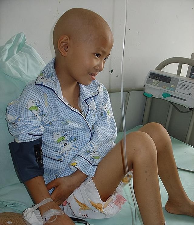 急性白血病能活多久