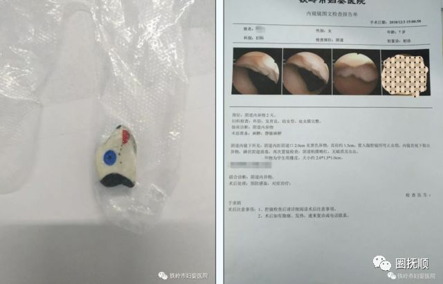 14岁阴道怎样可以变白