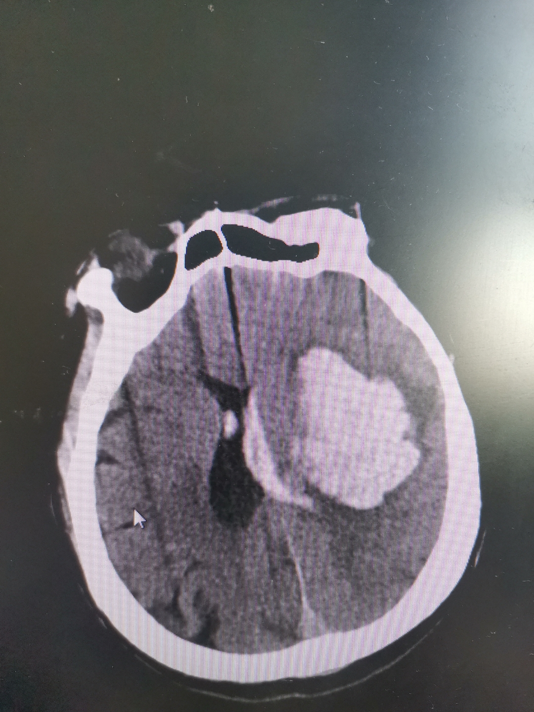 头部核磁共振痛苦吗