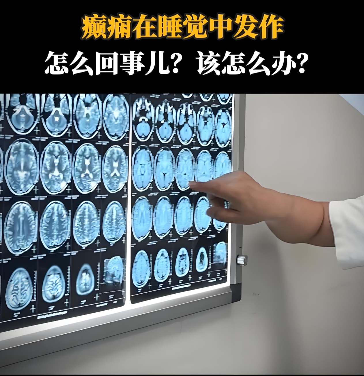 头部核磁共振痛苦吗