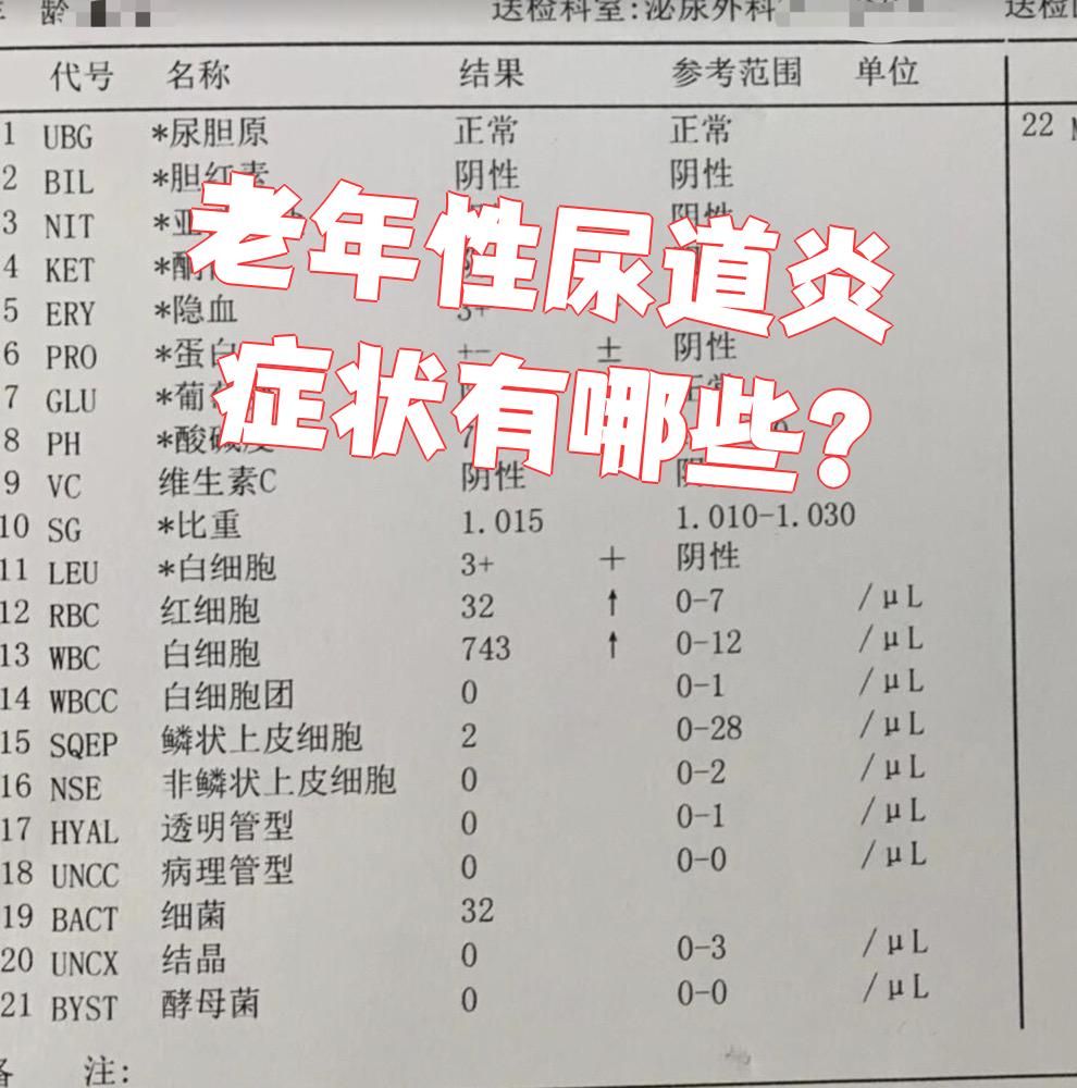 尿道炎有哪些表现症状呢