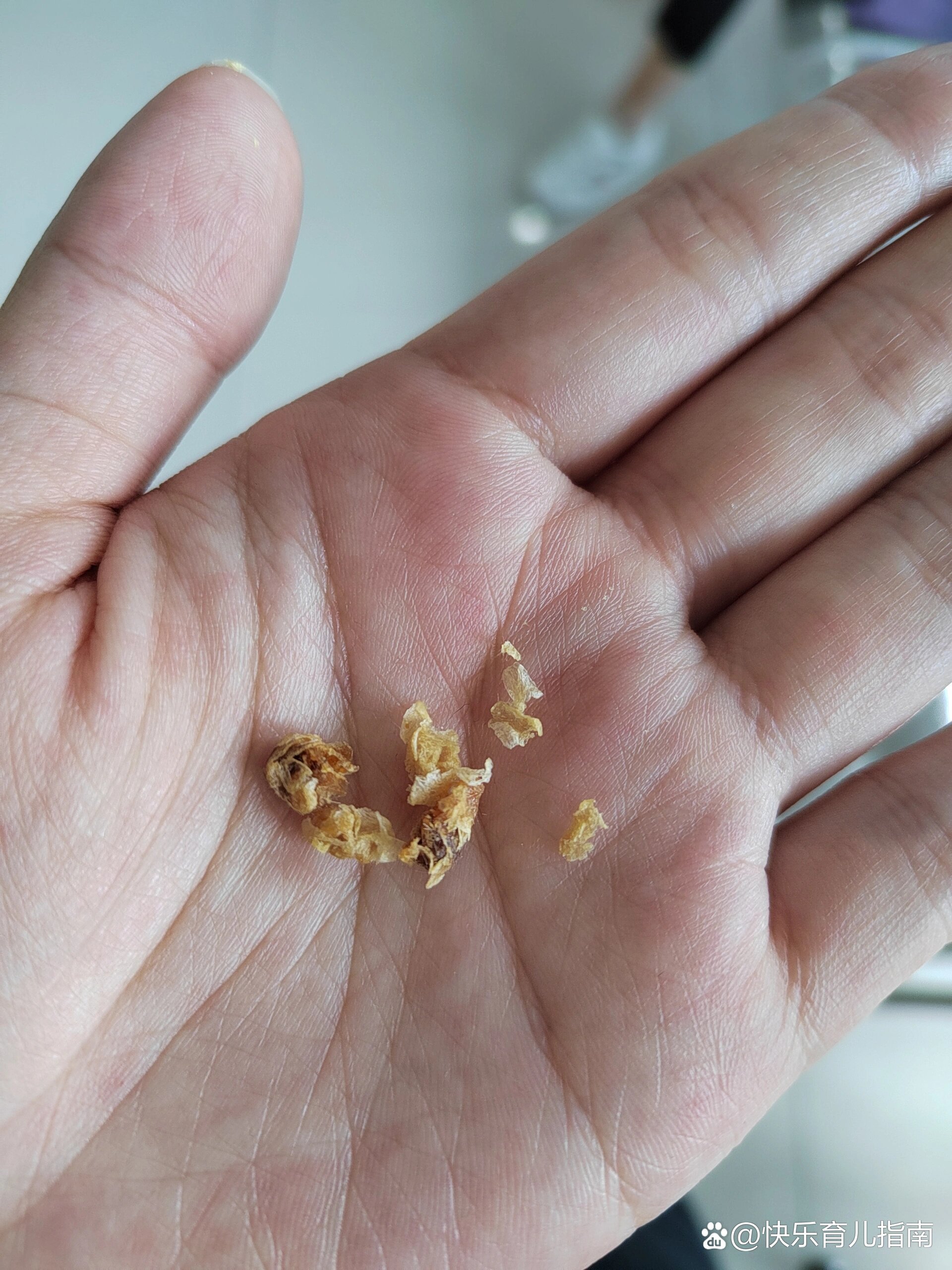 挖耳朵挖痛了能自愈吗