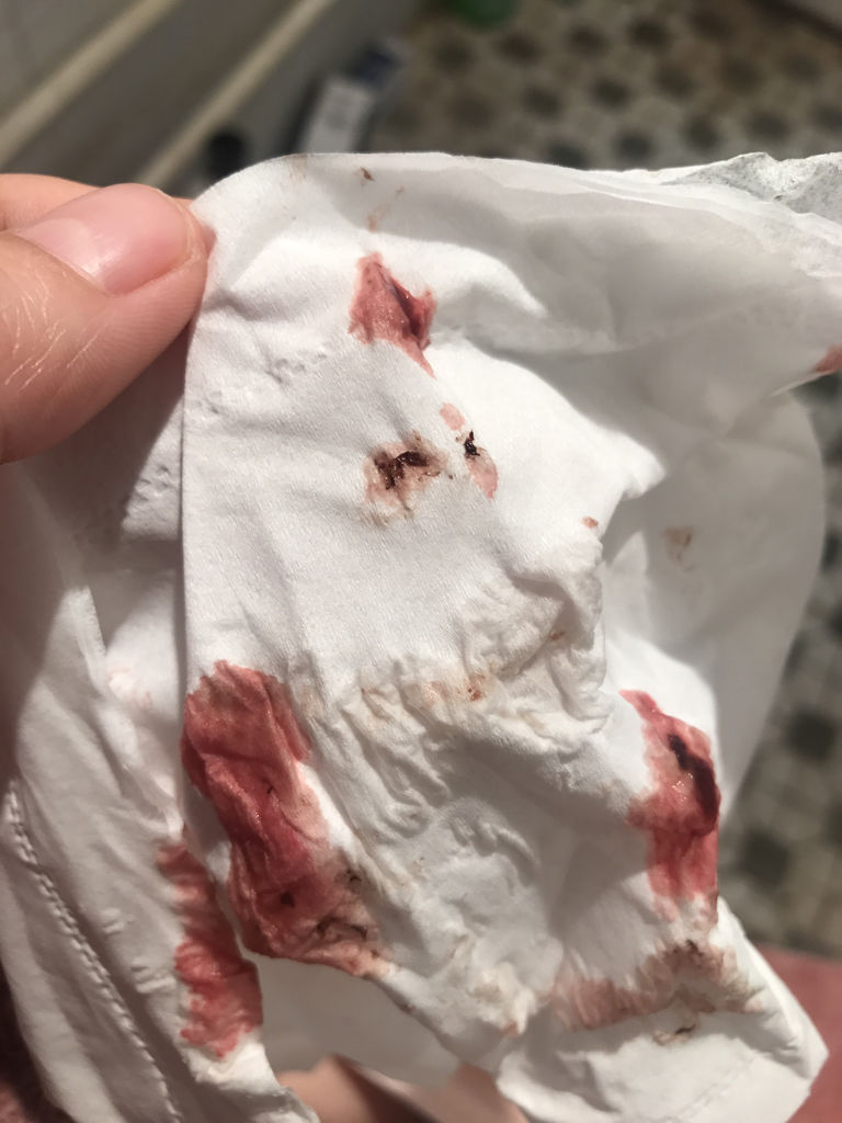 流产先兆是什么