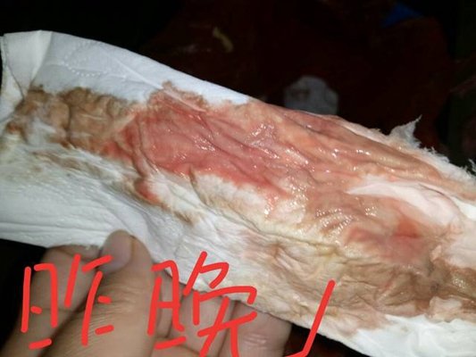 流产先兆是什么