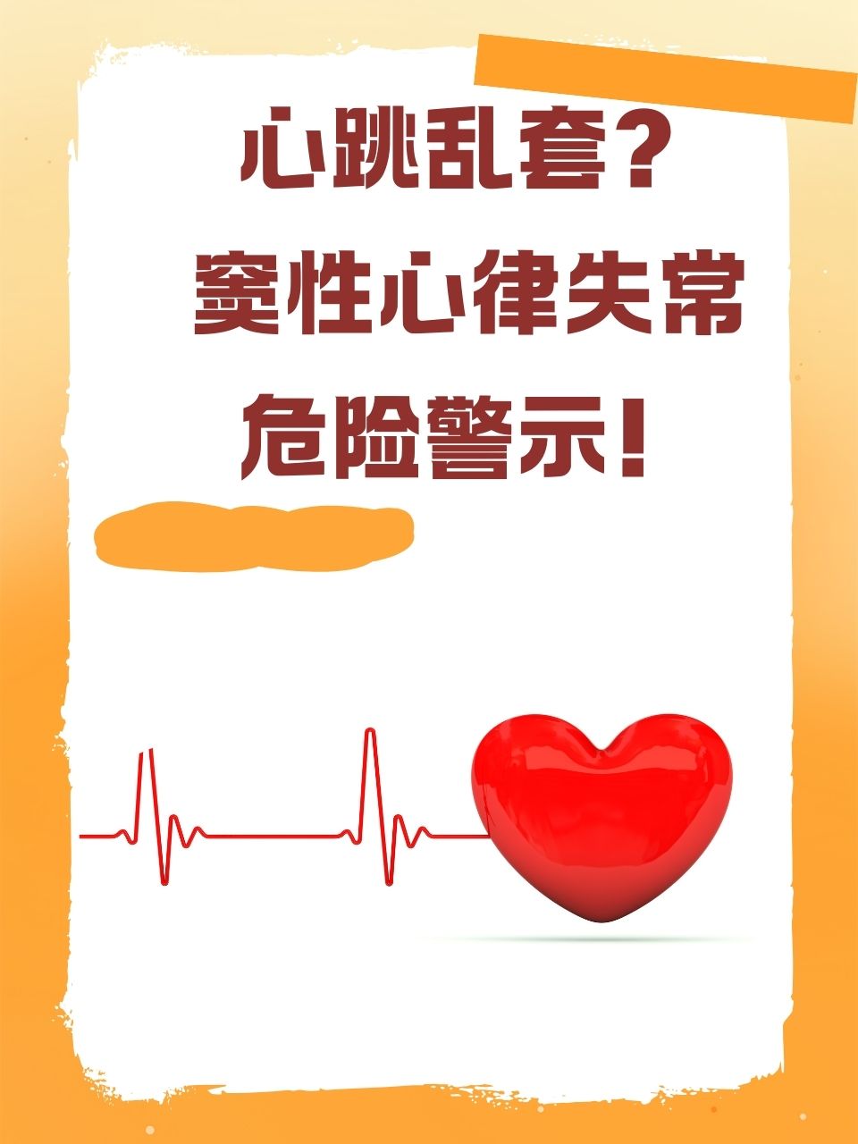 窦性心律不齐是什么意思?