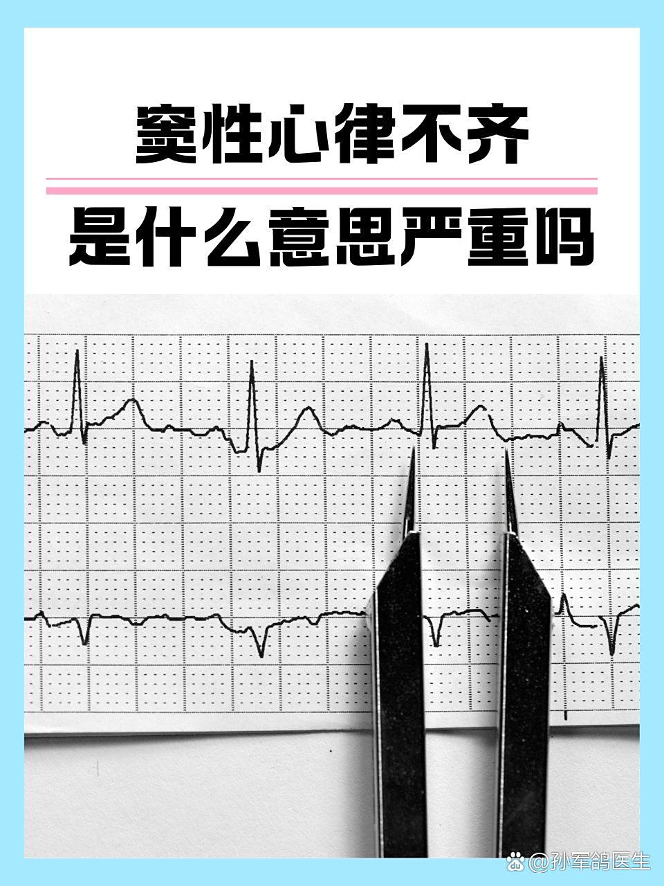 窦性心律不齐是什么意思?