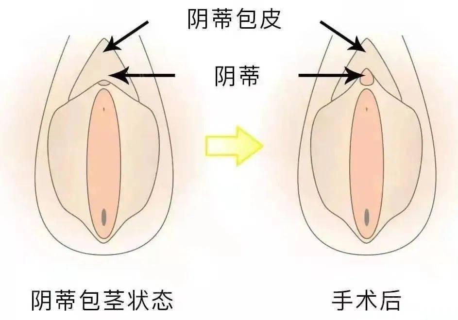 阴道分泌物具体指什么