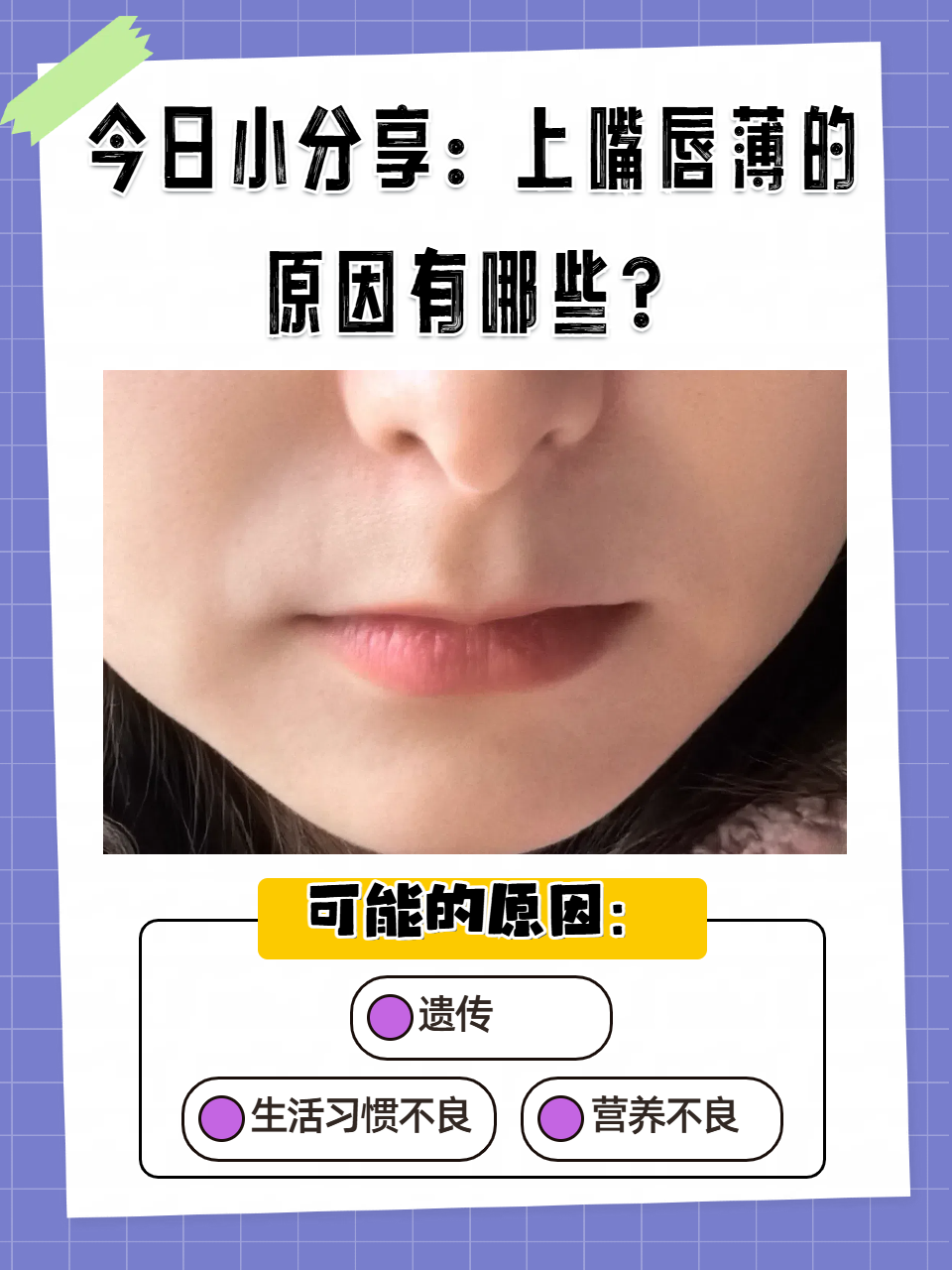 嘴唇变薄的自然方法有哪些