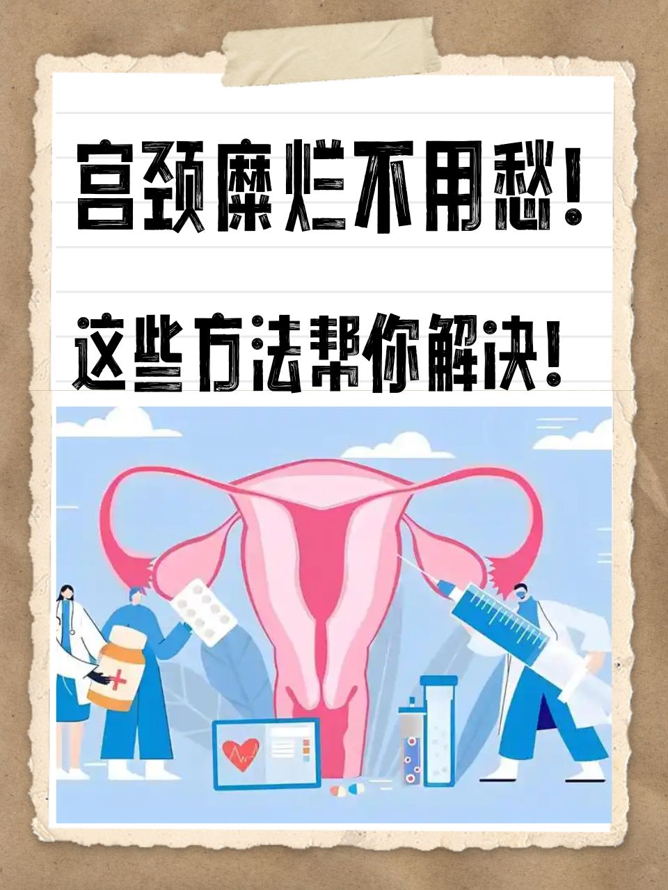 宫颈糜烂的治疗