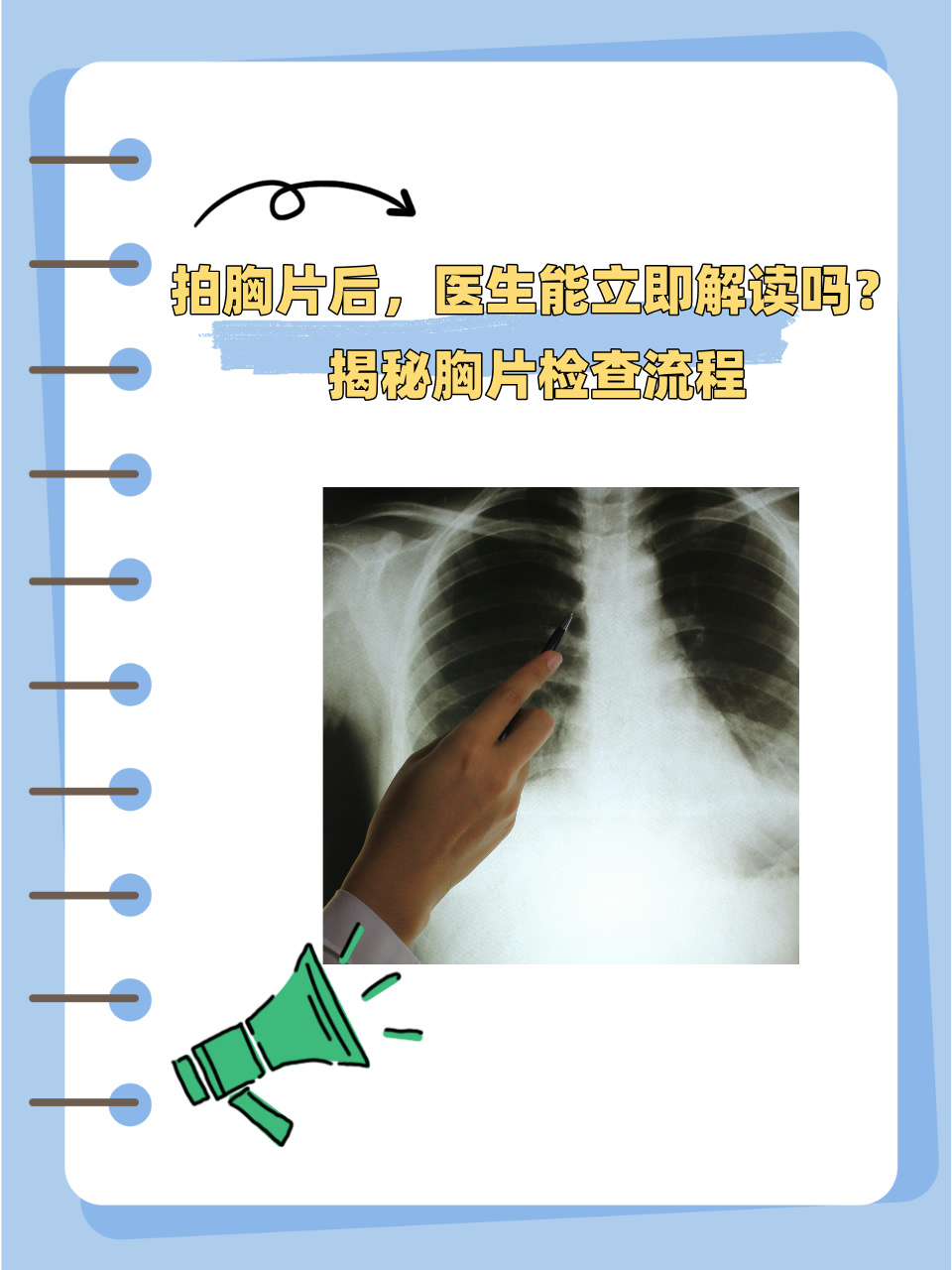 拍胸片能查出什么?