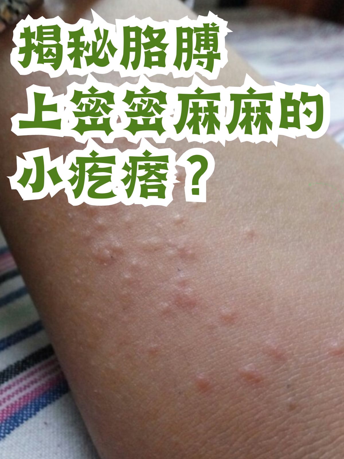 为什么全身长了很多白色的小疙瘩?