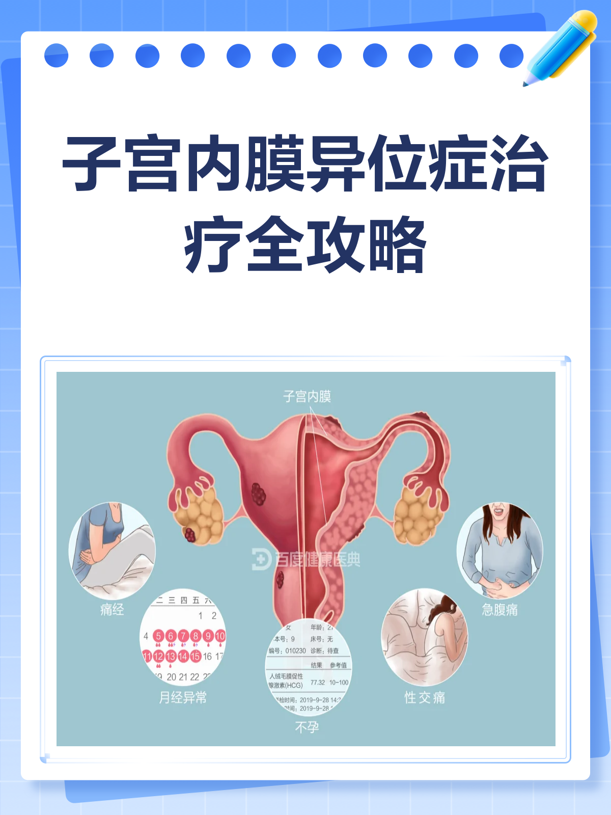 子宫内膜异位症怎么查