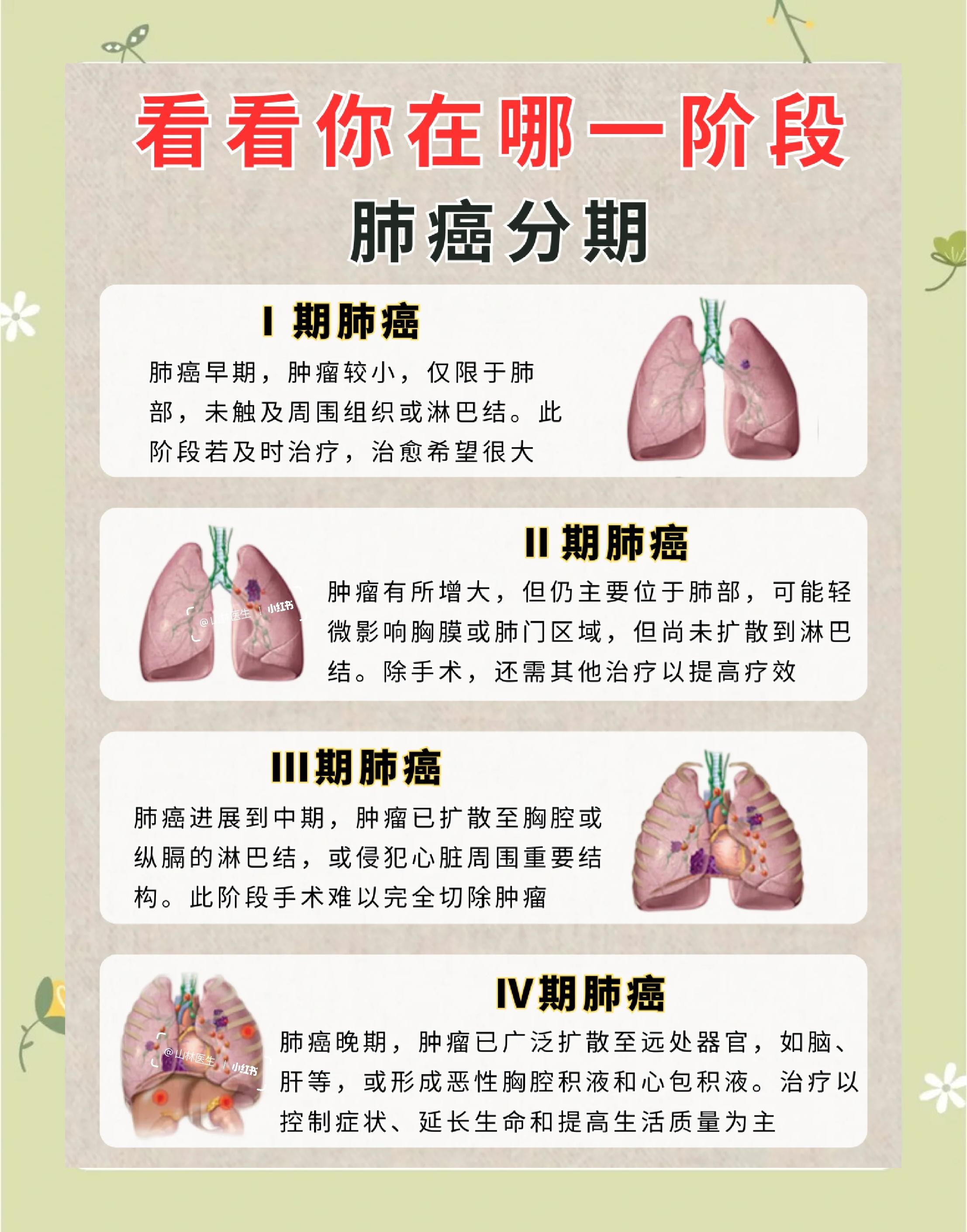 肺癌晚期可以治好吗