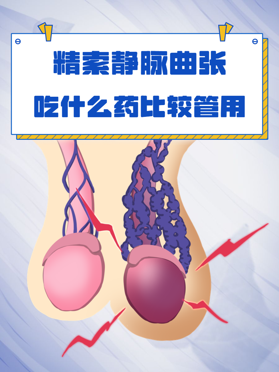 精索静脉曲张是怎么得的