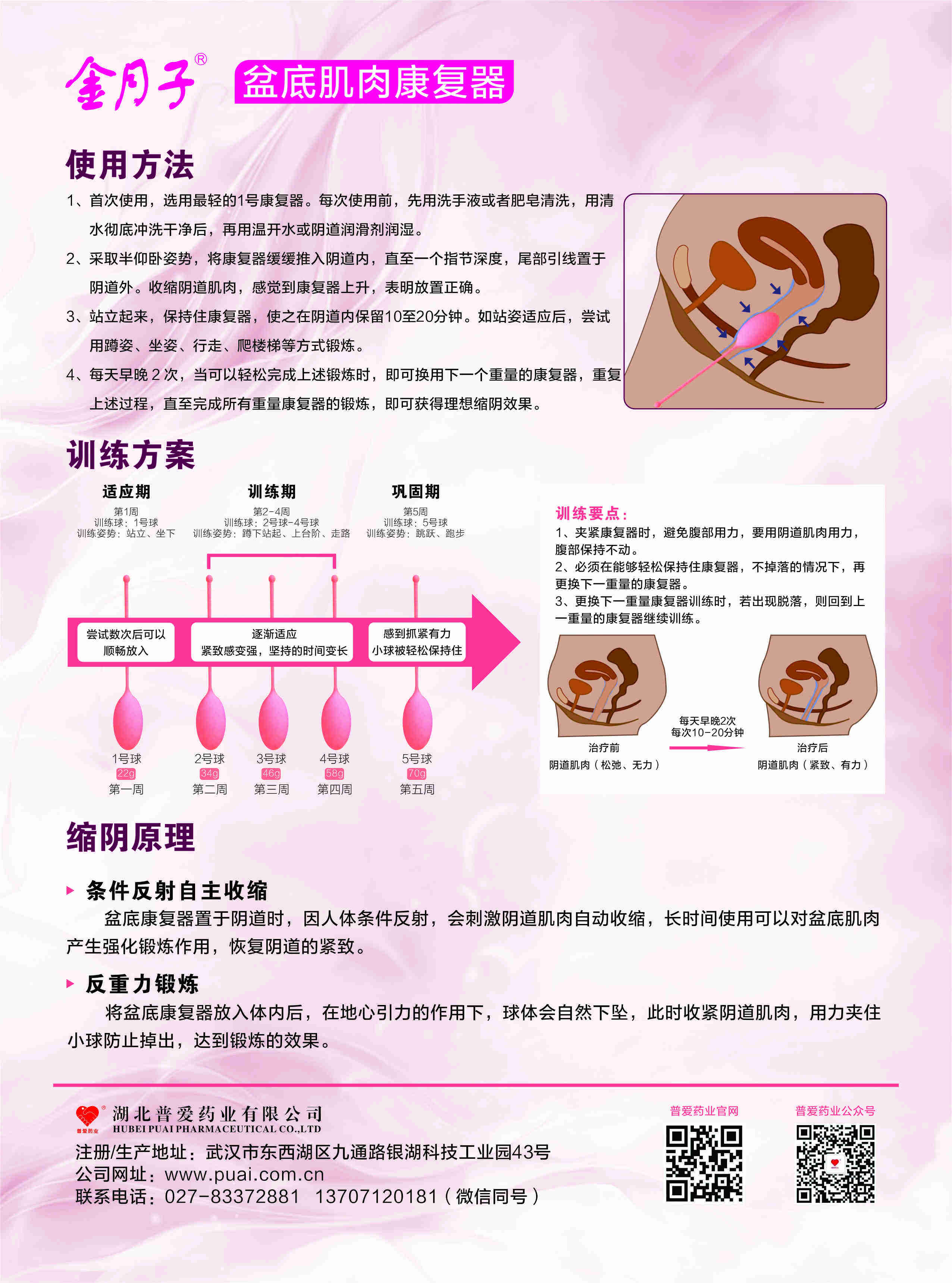 产后50天,阴道壁膨出