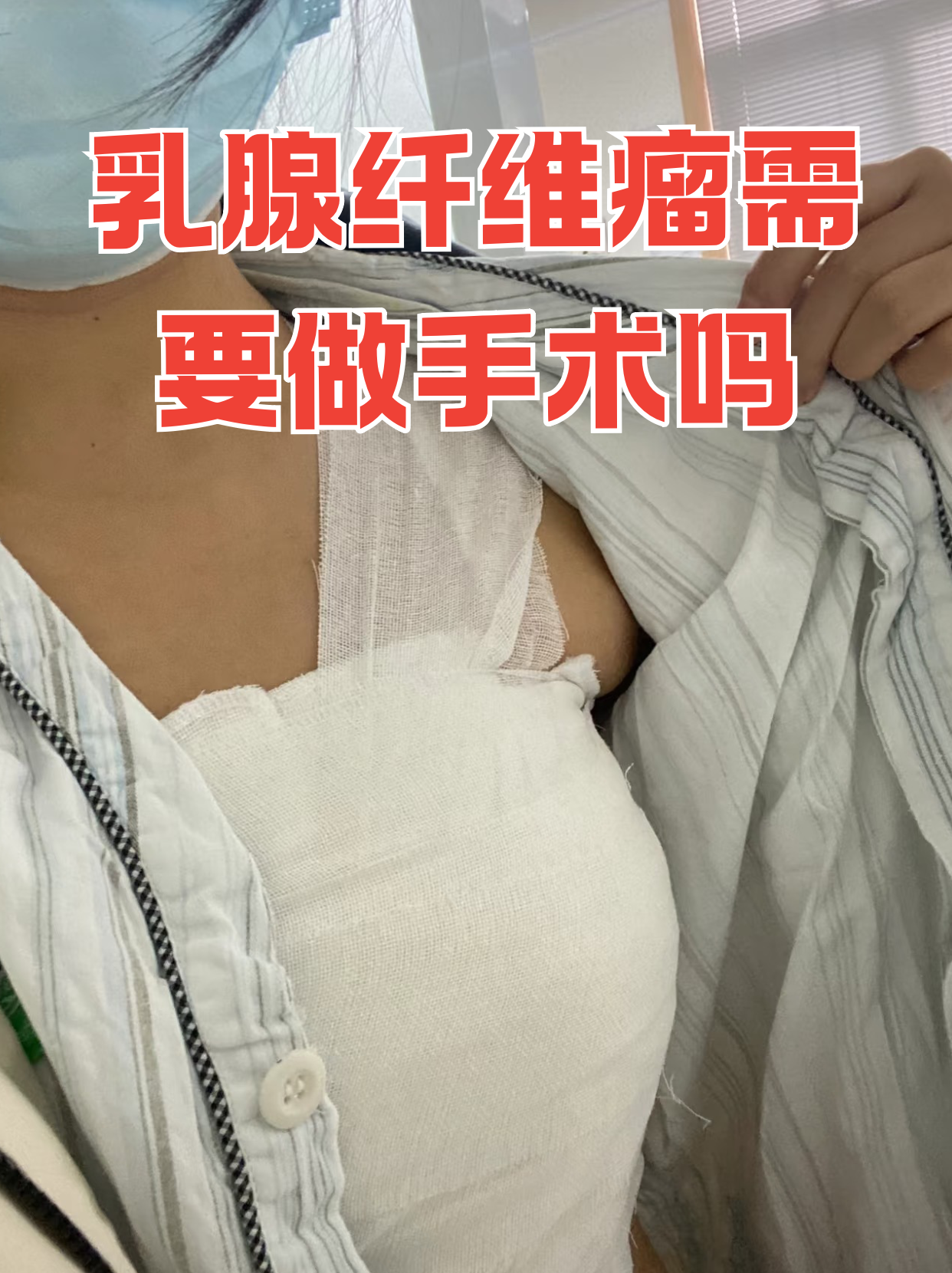 乳腺肿块需要手术吗