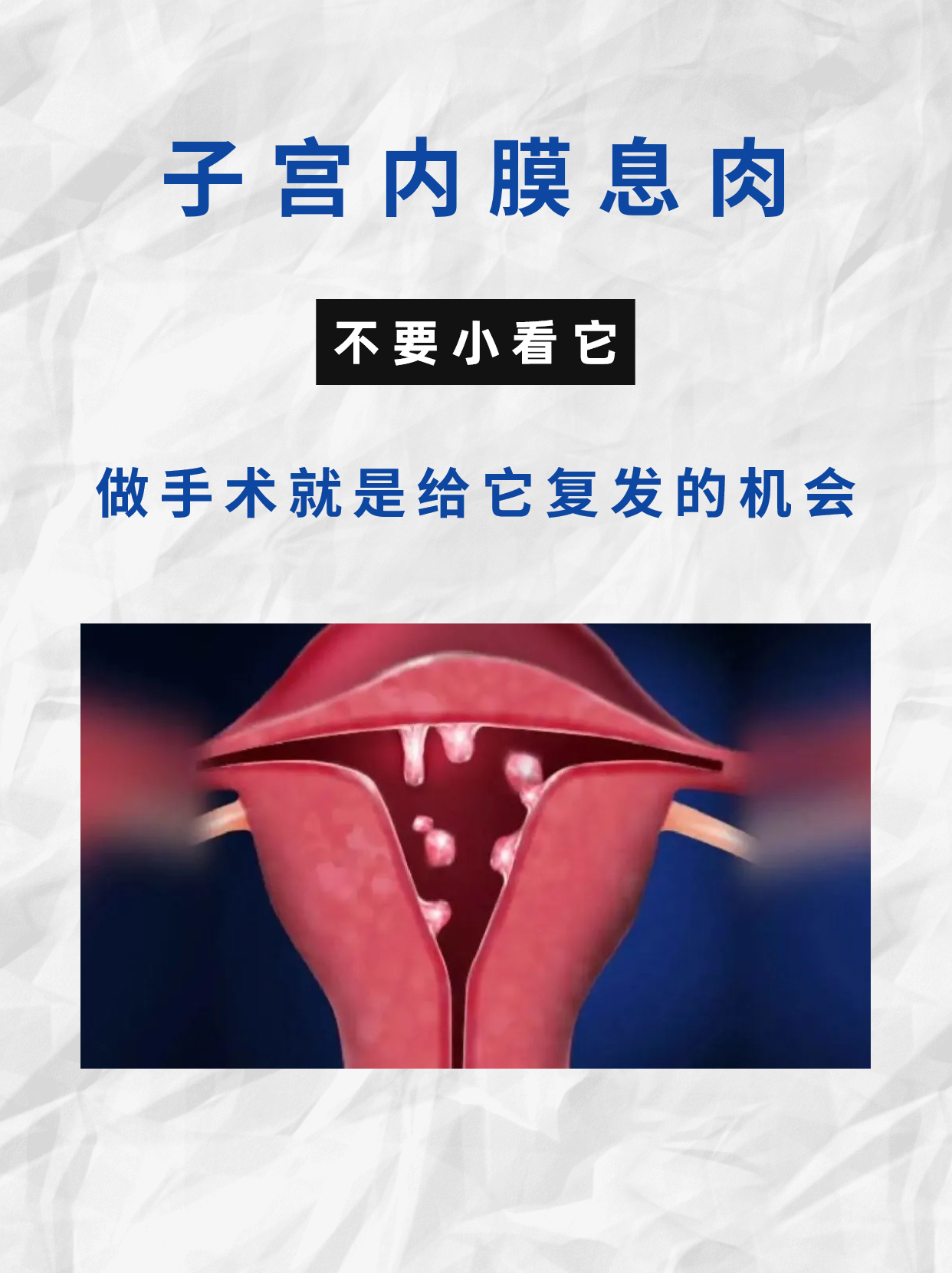 子宫内膜息肉的危害有哪些?