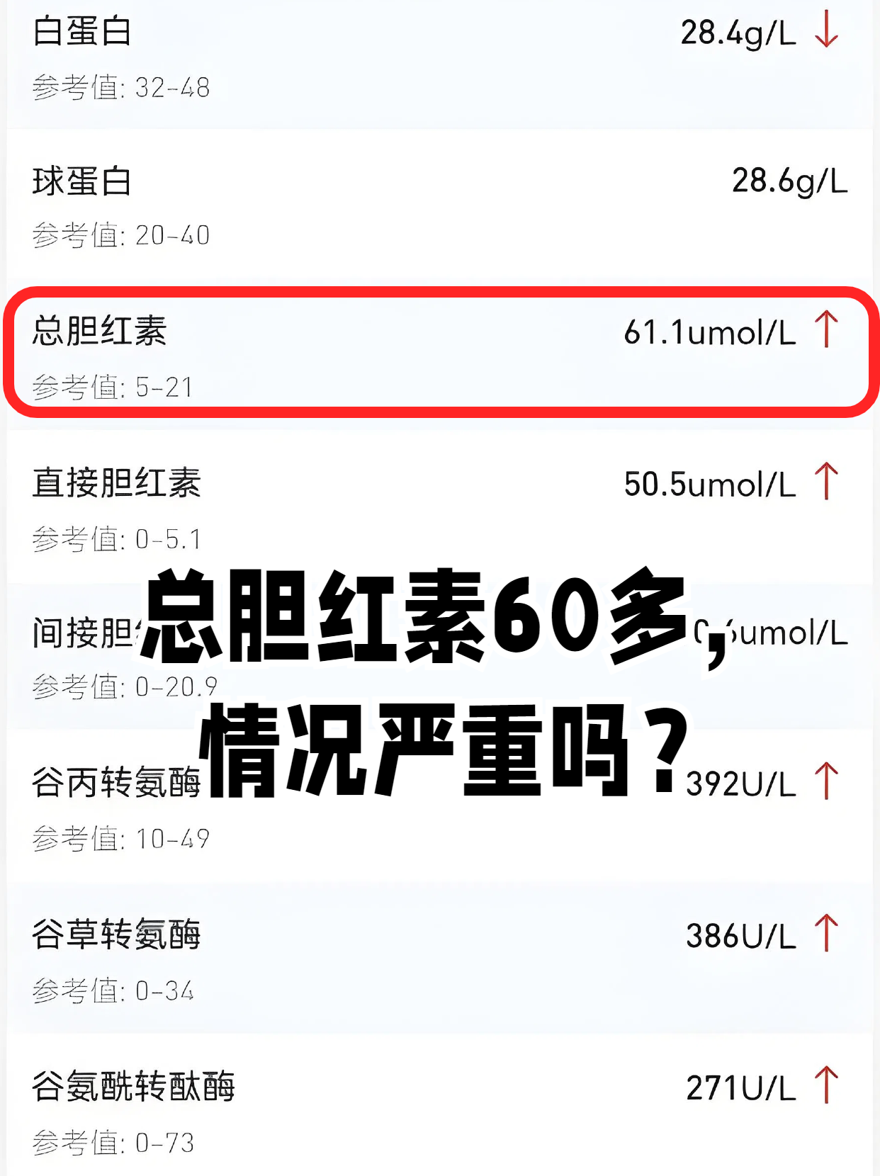 胆红素高不能吃什么