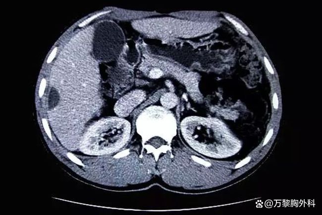 ct检查对身体危害大吗