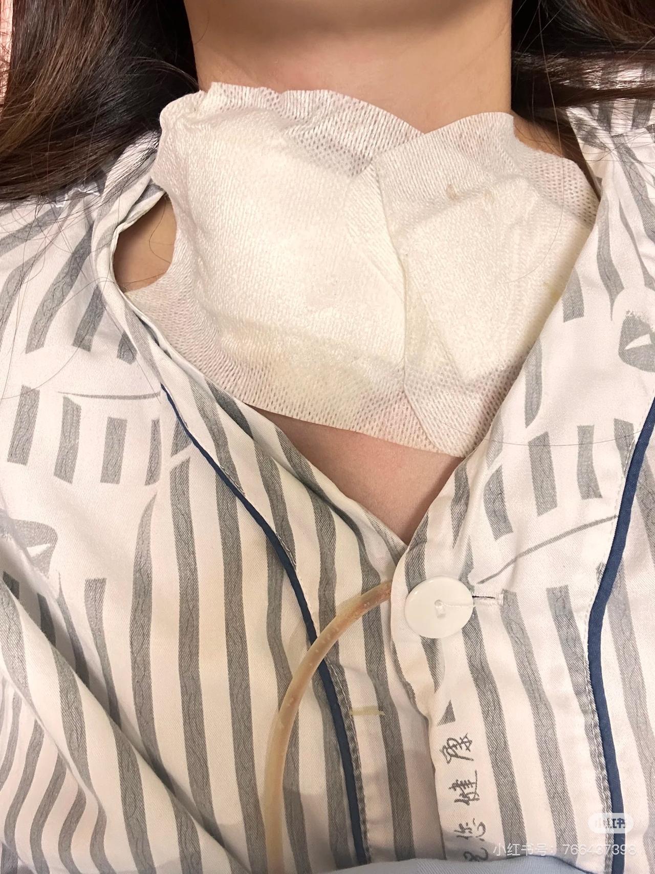 甲状腺穿刺活检的危害有哪些