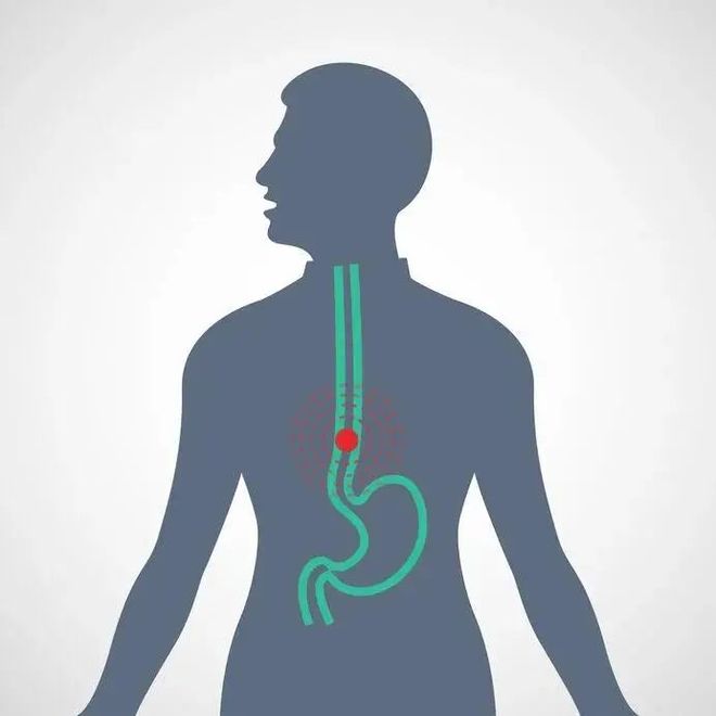 怎样快速得癌症最好就在一个月