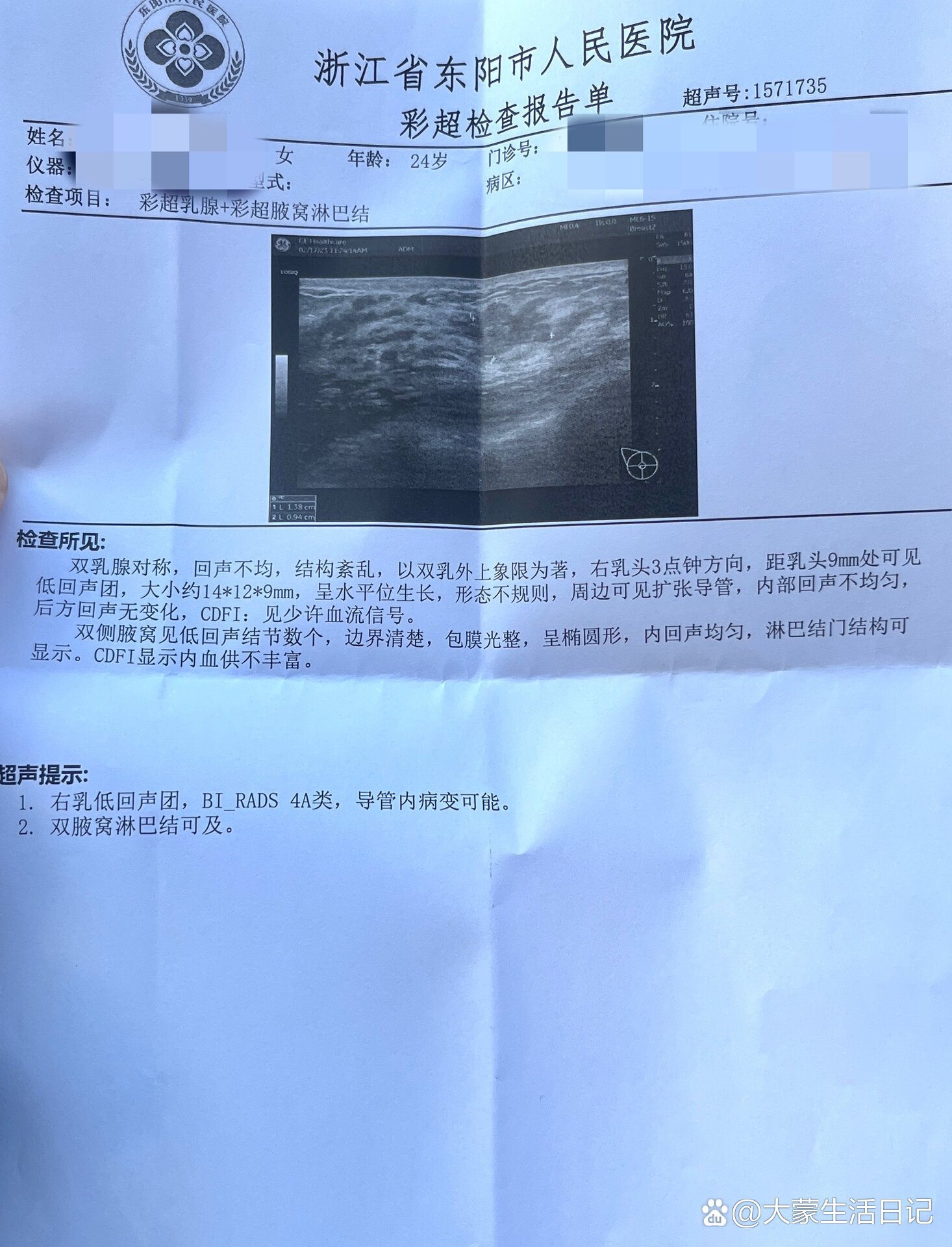 什么是乳腺低回声结节