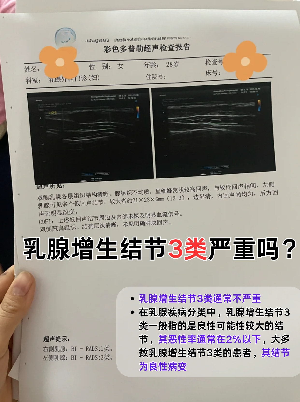 什么是乳腺低回声结节