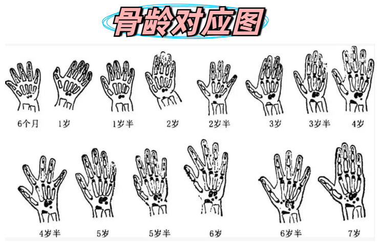 什么样的叫骨骺线闭合
