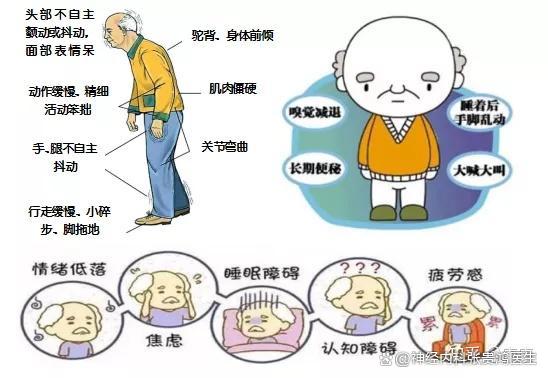 特发性震颤的症状有哪些
