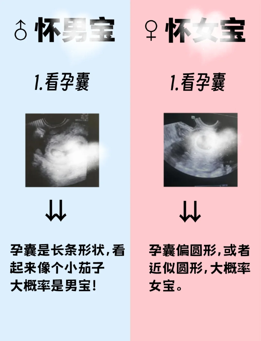 验血测男孩女孩准吗,
