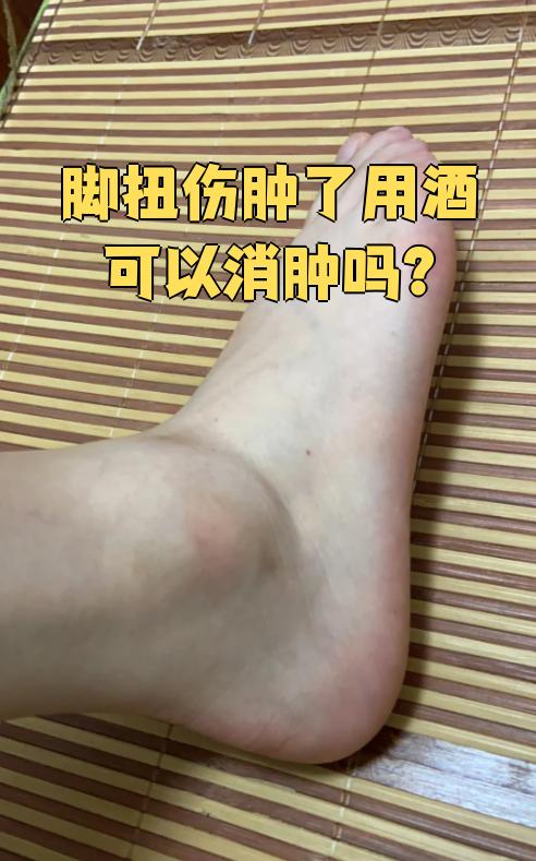 脚崴了,短期内怎么消肿