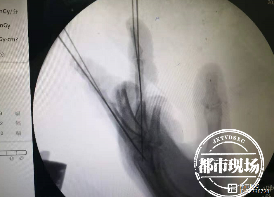 第一次可以进2根手指吗