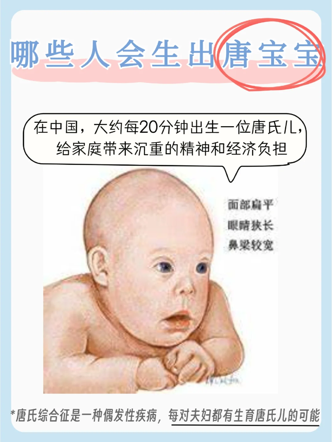 什么是唐氏综合征?