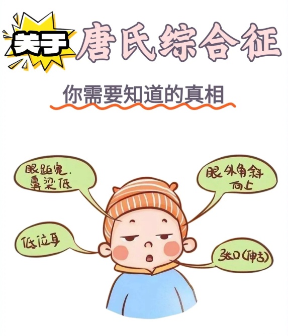 什么是唐氏综合征?