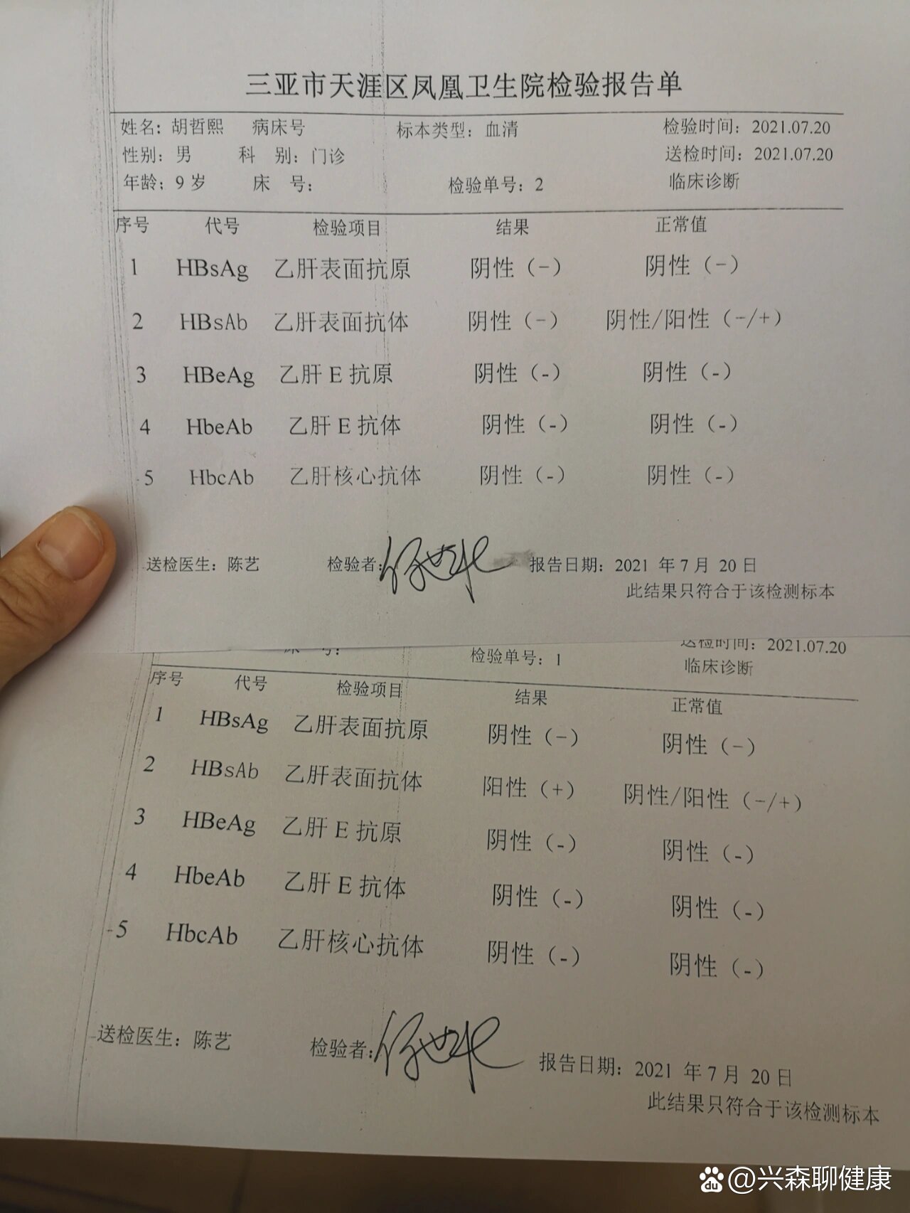 乙肝表面抗体的正常值是多少