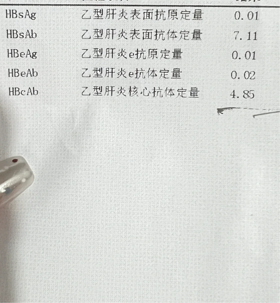 乙肝表面抗体的正常值是多少