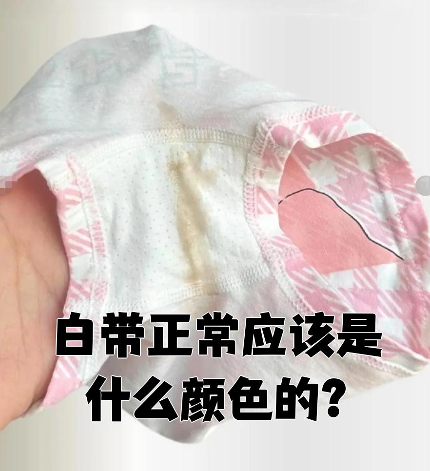 白带什么颜色是正常的