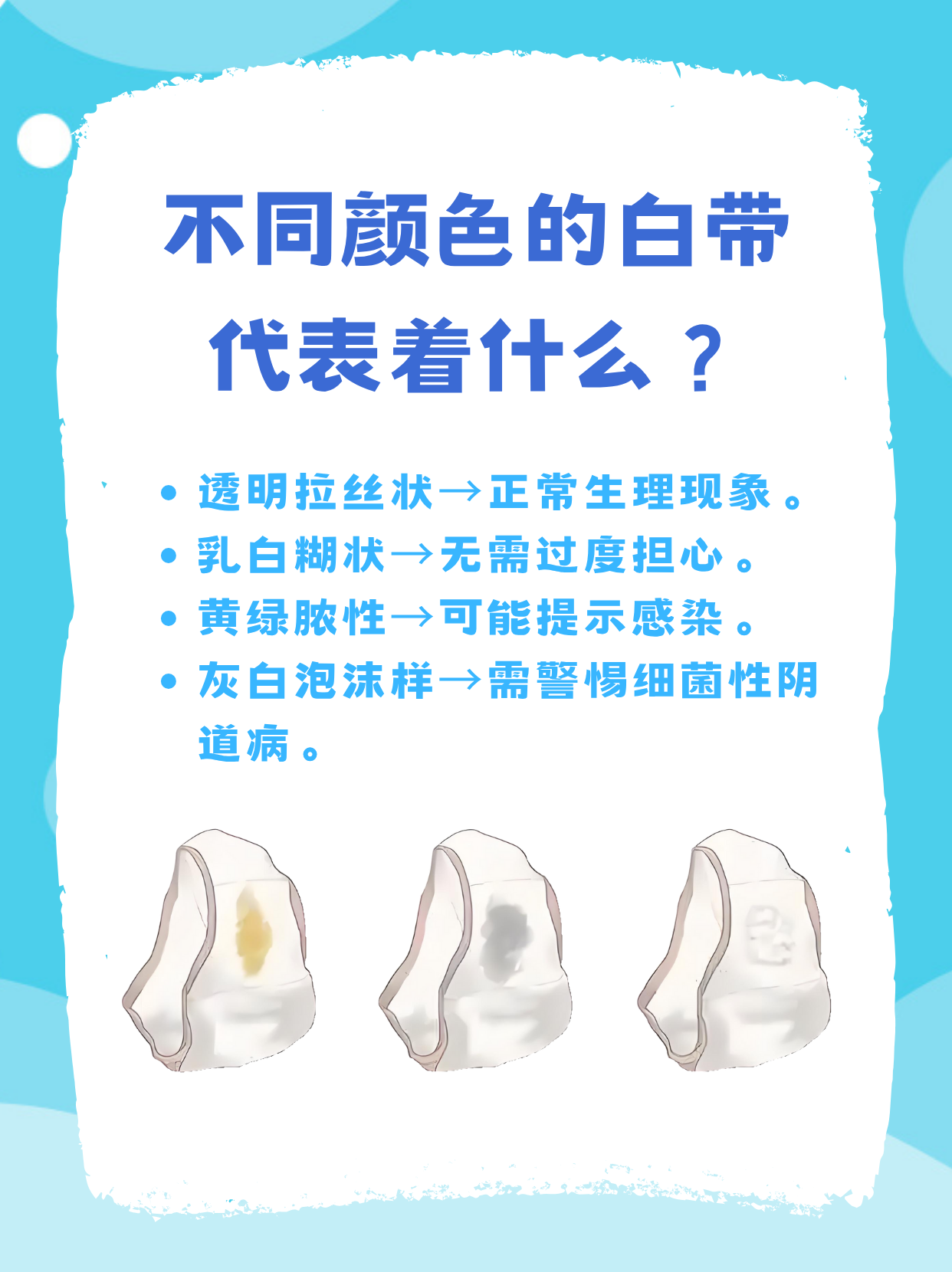 白带什么颜色是正常的