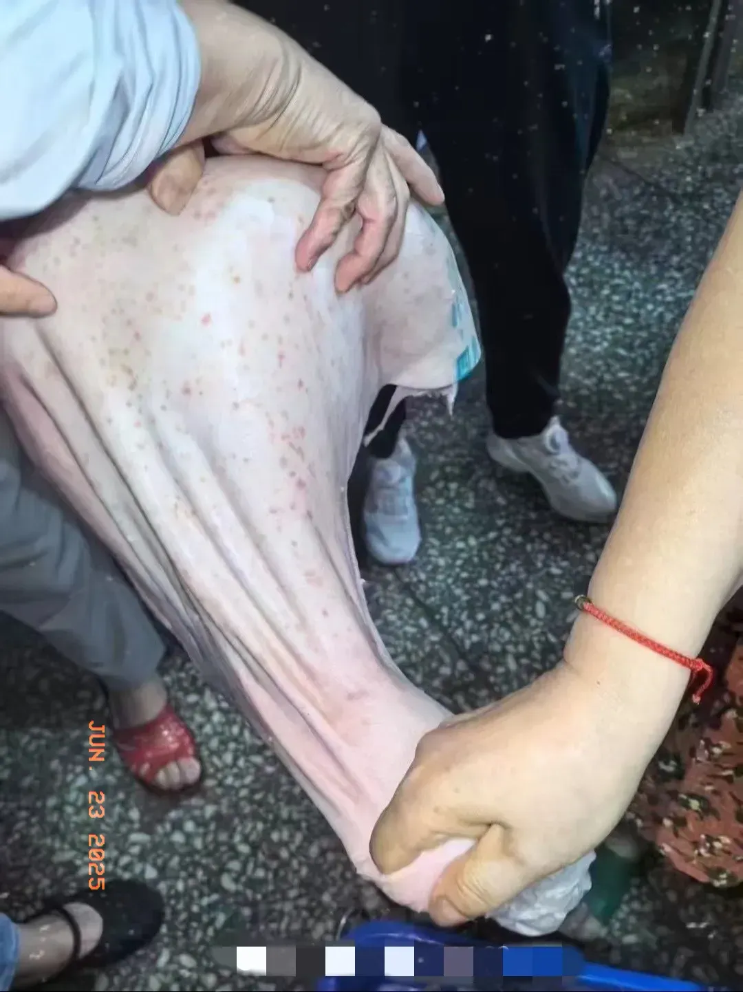 人得猪瘟疫什么症状人被传染猪瘟疫后有什么突出症状