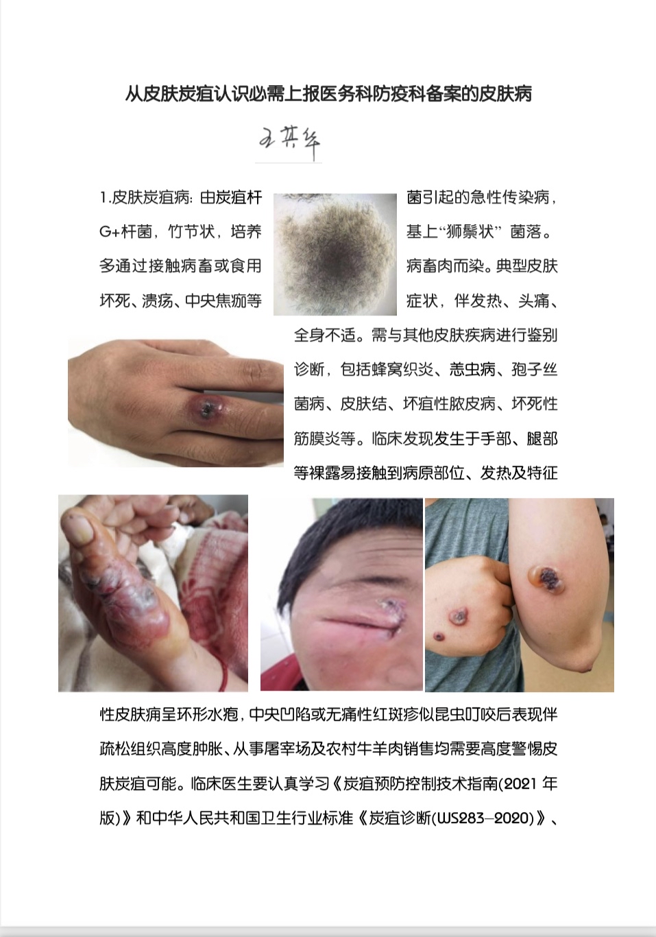 人得猪瘟疫什么症状人被传染猪瘟疫后有什么突出症状