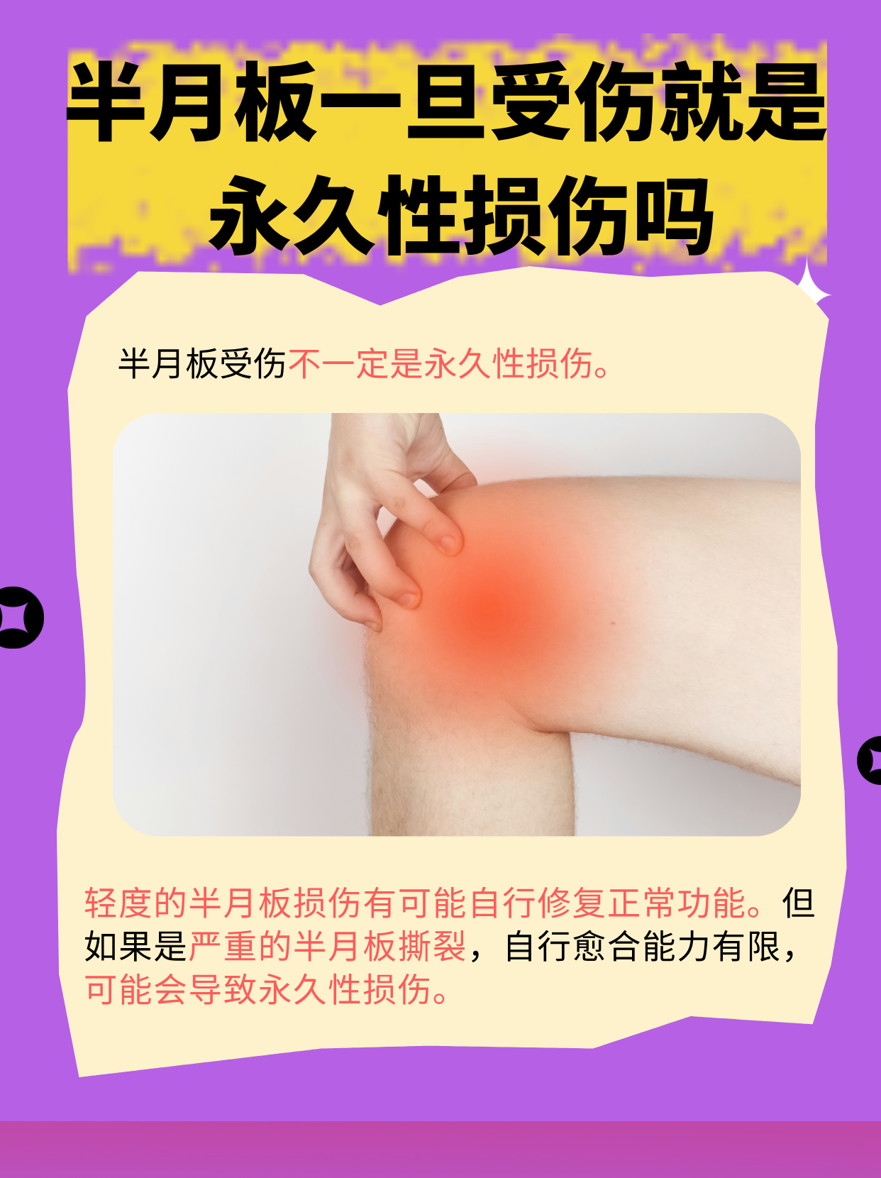 半月板损伤2级严重吗