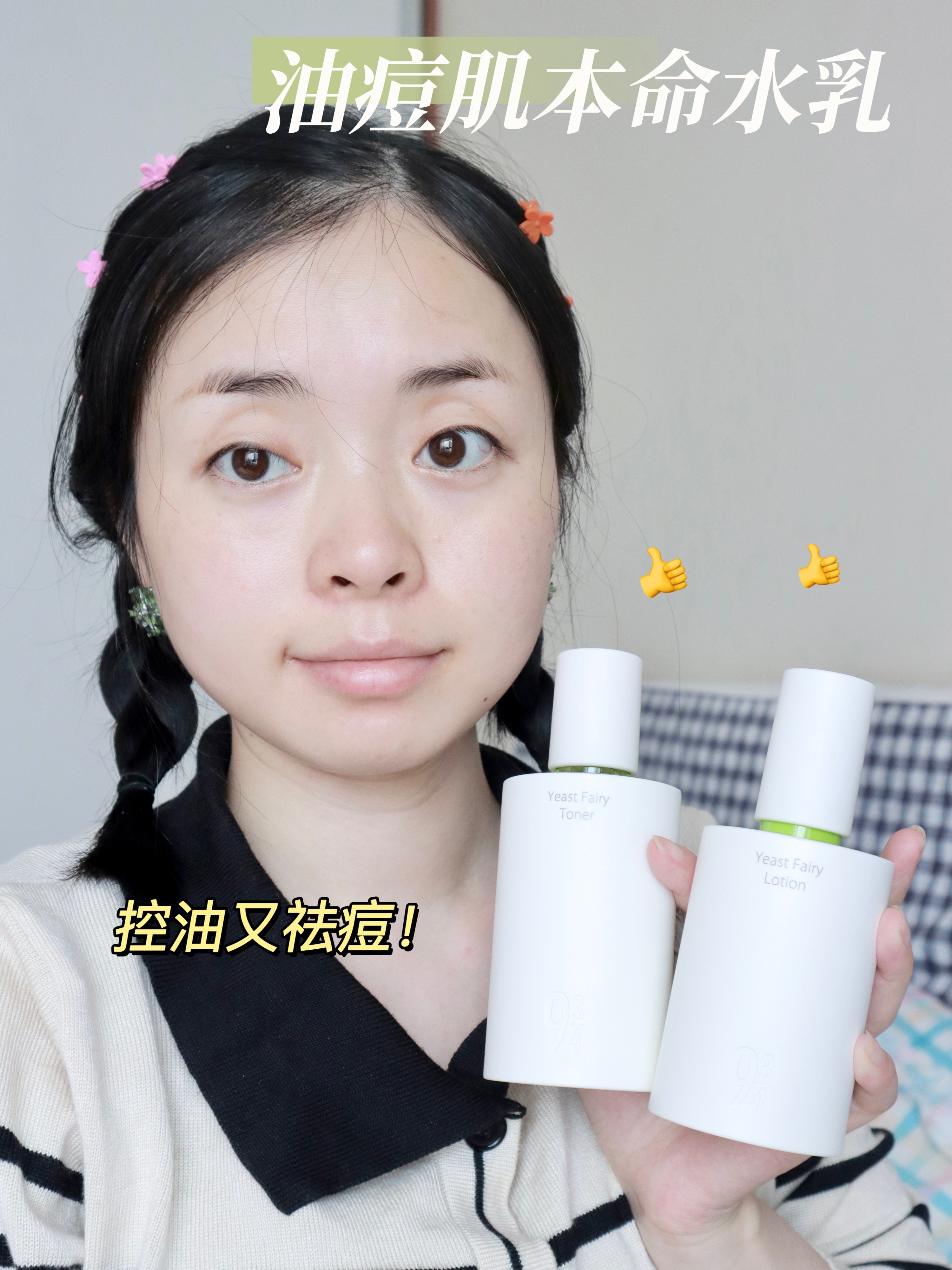 额头出油是怎么回事啊?谢谢!